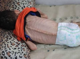 Qəzzada Humanitar Fəlakət və Soyqırım