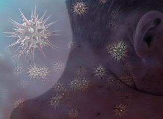 Nigeriyada qızılca epidemiyası yayılıb